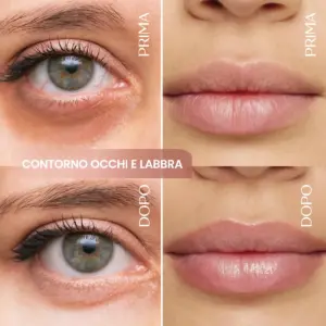 Contorno Occhi e Labbra RIMPOLPANTE alla Caffeina + Acido Ialuronico - immagine 2