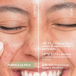 Siero Viso ASTRINGENTE Purificante - Pelle Mista / Grassa - immagine 4